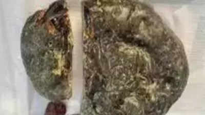 Rs 1.58 crore worth whale vomit (ambergris) seized near Vadodara; six arrested