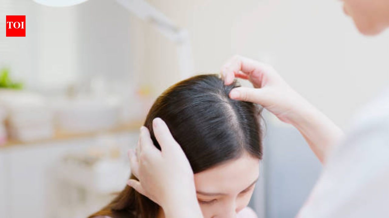 Hair loss, hair thinning might be the first symptom of these health ...