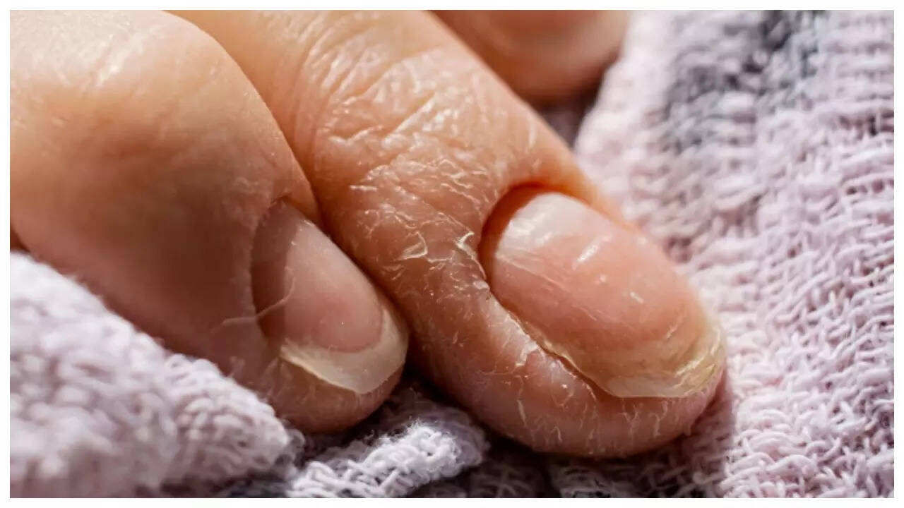 10 hidden warnings that our nails give about the body's health | - Times of  India