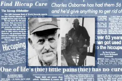  The man who had a hiccup spree for 68 years