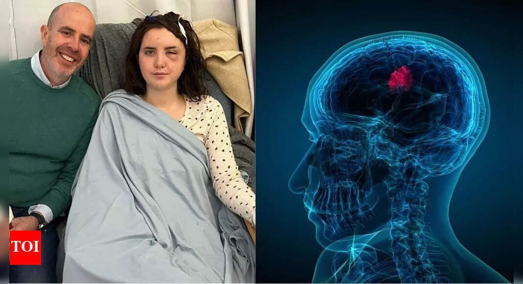 A woman's brain tumour was mistaken for heatstroke: What you need to know about gliomas, its symptoms and causes | - Times of India