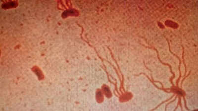 Ancient killer drug-resistant typhoid strains is becoming untreatable and spreading across the globe; study warns