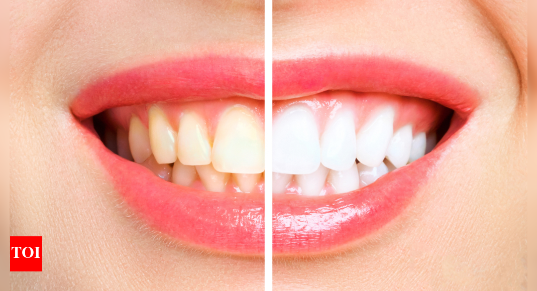 How to remove yellow stains from teeth: 3 tips that always work – Times of India