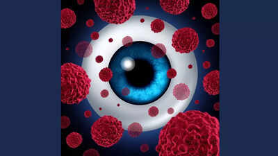 Source: Eye cancer Eye cancer common signs and symptoms that you should know