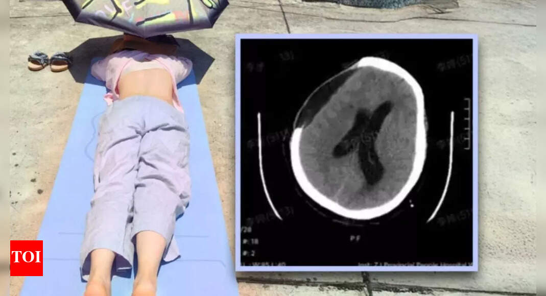 Chinese woman suffers brain hemorrhage, slips into coma after sunbathing during extreme heatwave; know the safe limit and health risks | – Times of India