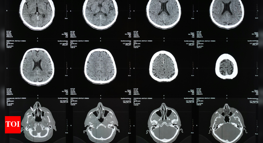 Dementia: This one thing about your sleep could predict brain decline |