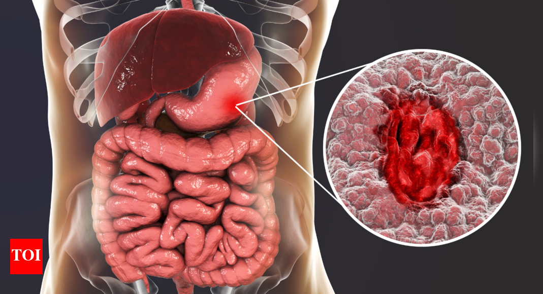 THIS common food additive is silently harming the body (and is eaten every day) – Times of India
