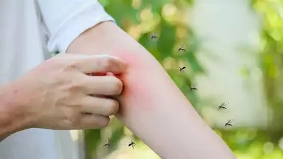 Chikungunya symptoms that might go unnoticed