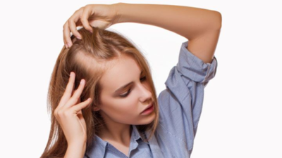 5 things to avoid when you’re struggling with alopecia