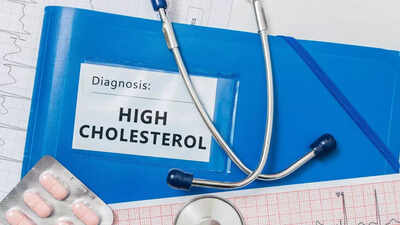 Habits that raise your cholesterol and how to break them