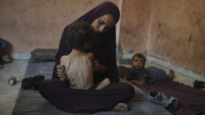 'Walking corpses': Photos of malnourished Gaza toddler go viral as humanitarian situation worsens; see pics inside