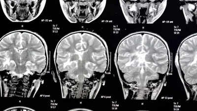 THIS silent threat around is eating away at the brain, even increasing the risk of dementia