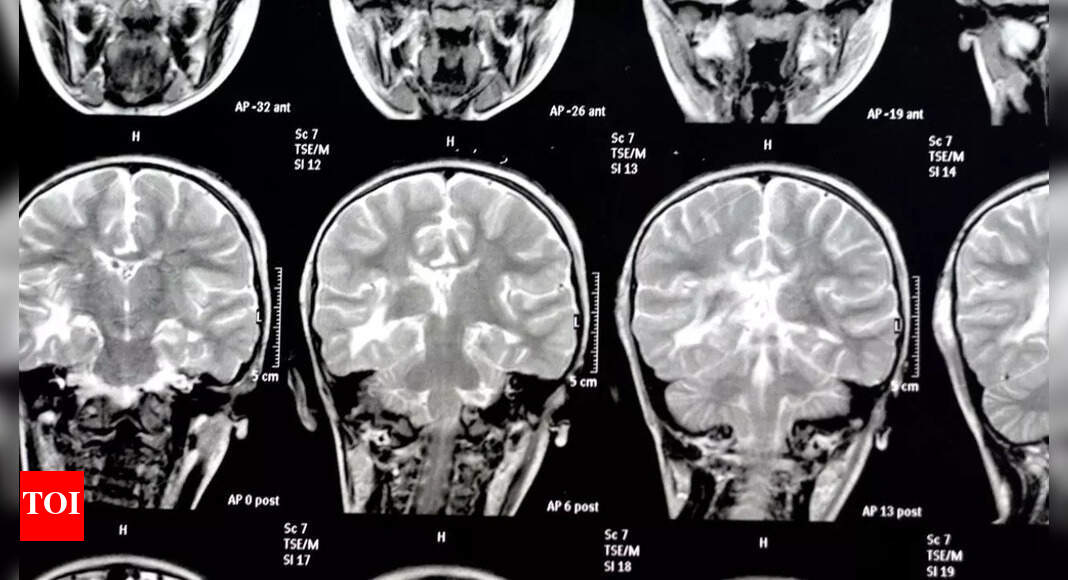THIS silent threat around is eating away at the brain, even increasing the risk of dementia | – Times of India
