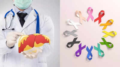 Can fatty liver building up most cancers menace? Know the indicators and the way to save you it | – Instances of India