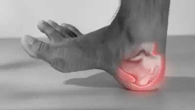 Why your heels hurt while walking: Hidden health causes explained