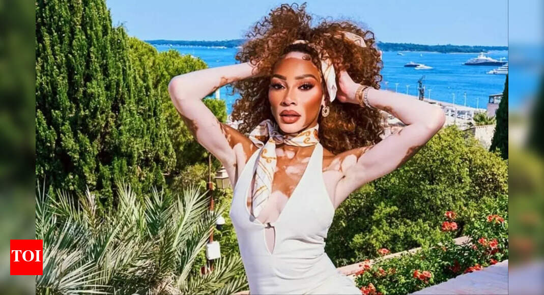 Winnie Harlow stuns in sultry birthday pics as she celebrates turning 31