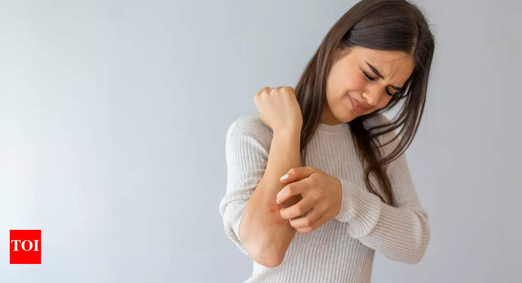 Top US doc reveals 4 skin changes that could mean liver disease | – Times of India