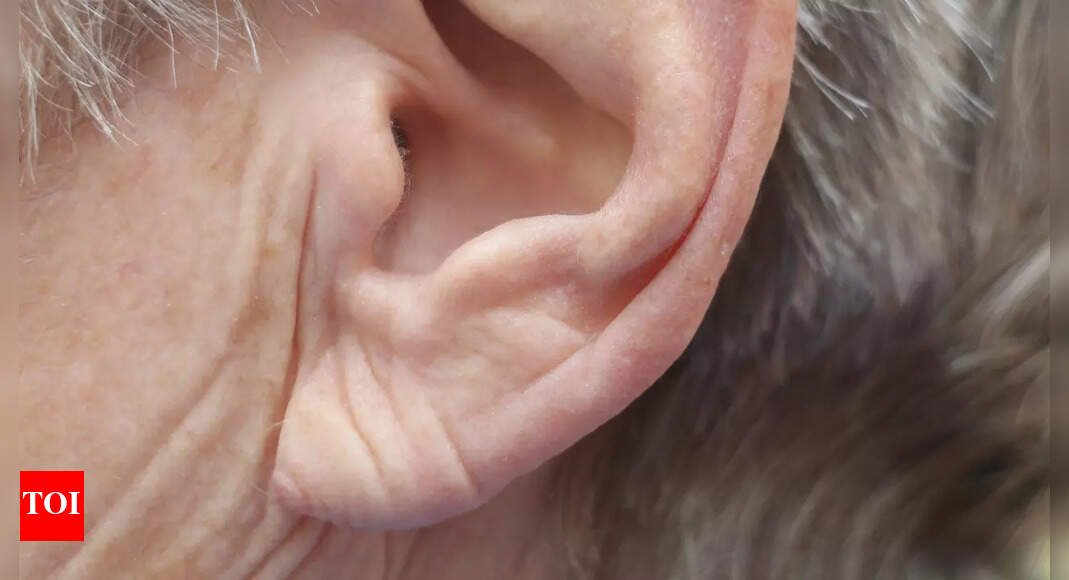 Heart Attack Symptoms: Earlobe crease a sign of a heart attack or stroke? Expert weighs in | – Times of India