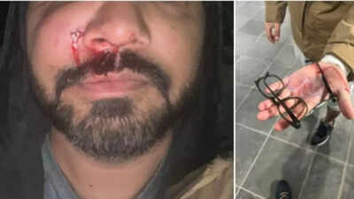  Indian-origin AI scientist Santosh Yadav attacked in Dublin, says it's not an isolated incident