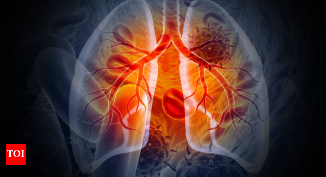 7 early warnings signs of lung cancer to keep an eye on