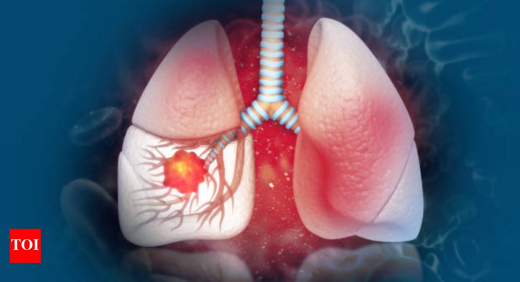 Lifestyle and lung cancer link: How daily choices raise or lower your risk