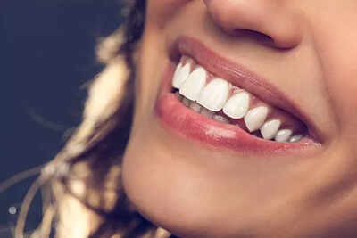 The best home remedy for sparkling white teeth and that perfect smile