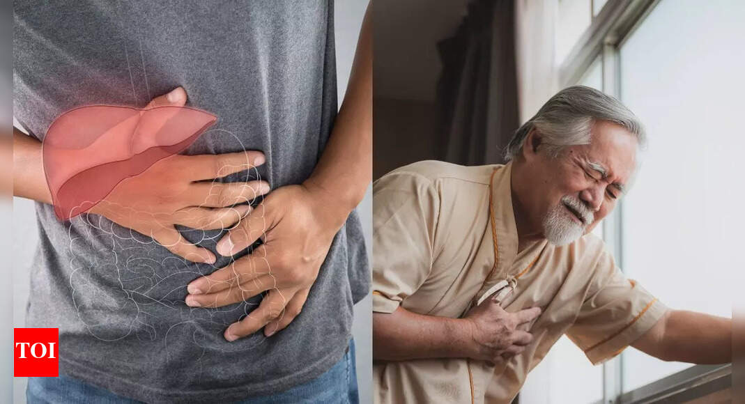 Fatty Liver Disease in South Africa: Risks, Complications & What You Need to Know