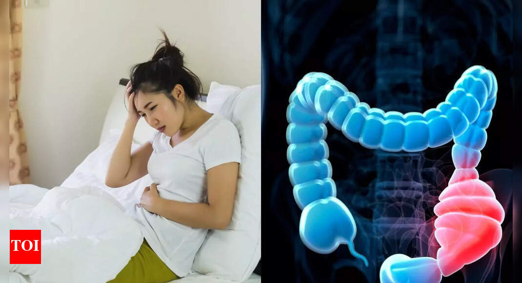 5 key reasons colon cancer is rising among young people; and ways to prevent | – Times of India