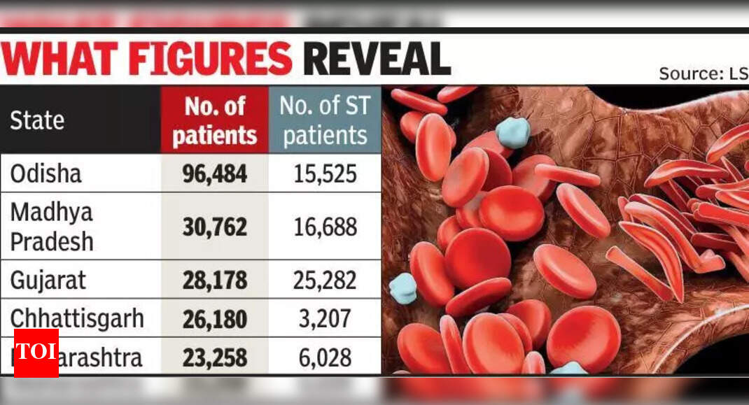 Gujarat ranks 3rd in sickle cell disease | Ahmedabad News - Times of India
