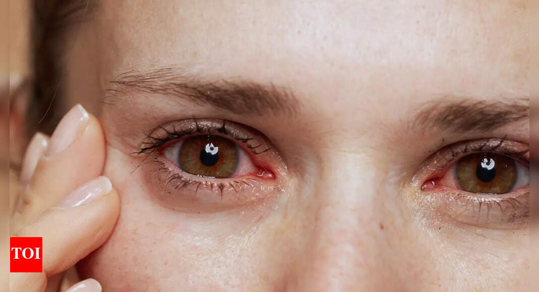 How to protect your eyes from infection this monsoon: 10 effective tips |