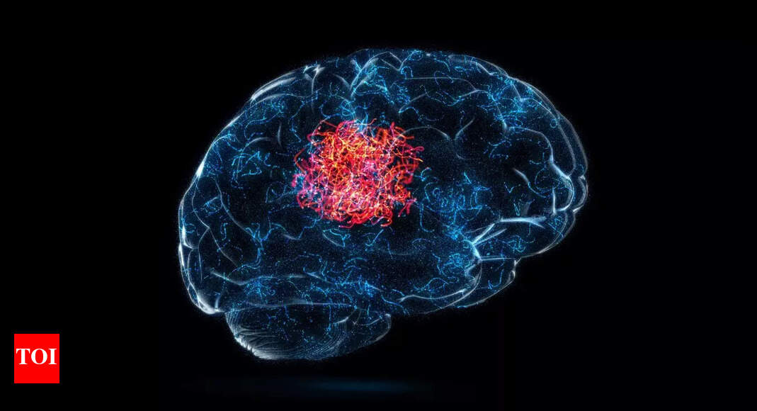 How a suspected flu led to a brain tumour diagnosis for a 26-year-old man: Don’t ignore headaches, fatigue, and other warning signs | – Times of India