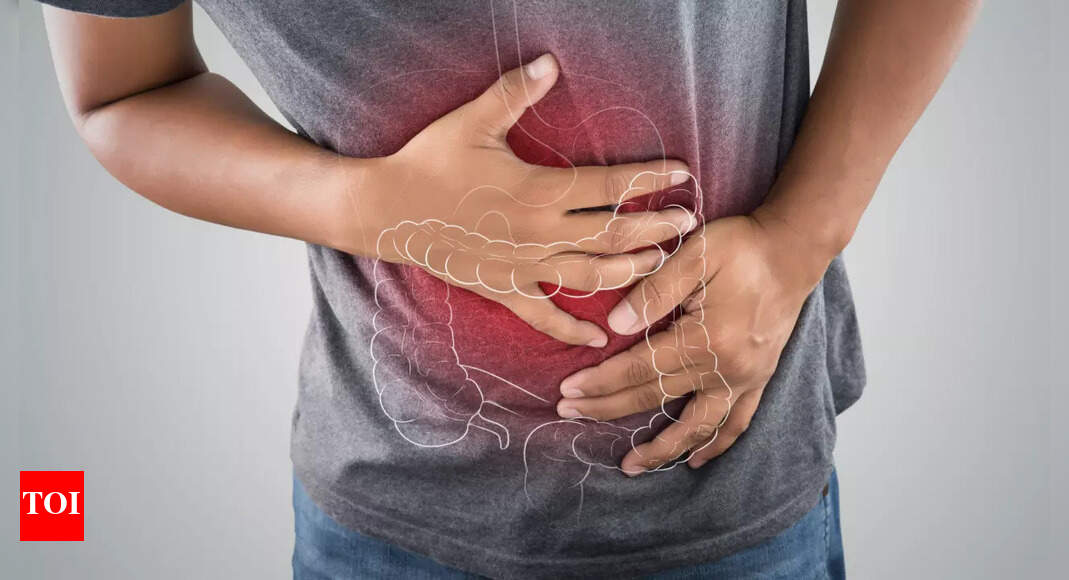 Bowel cancer on the rise: Experts reveal the hidden factor that increases the risk of colorectal cancer |