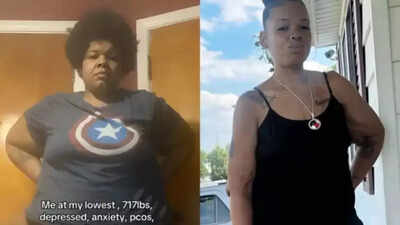 From 325 kg to 166 kg: How a correct diagnosis after years of misjudgment changed this woman’s life