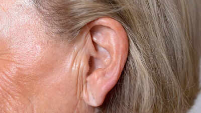 Can earlobe crease predict heart attack, diabetes and stroke risk: Myths vs facts