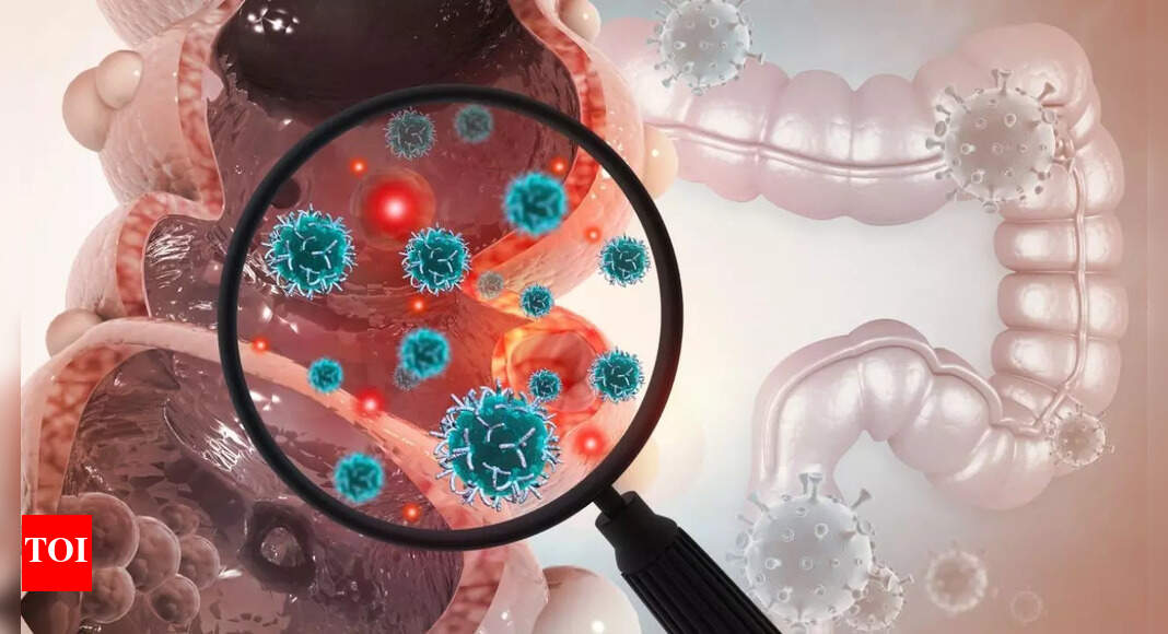 Bowel Cancer Symptoms: 5 warning signs of bowel cancer and how to reduce the risk, according to a gut expert |
