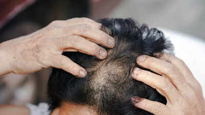 5 common mistakes older women make that worsen hair loss