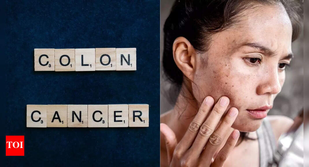 Colon cancer symptoms on skin: What you need to know |