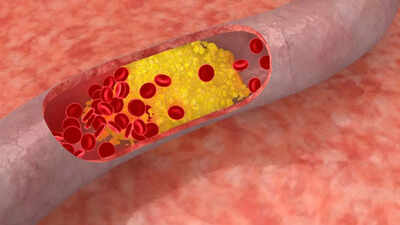 Doctor shares natural ways to lower cholesterol without medication