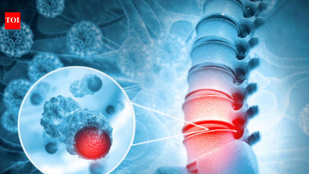 7 foods that weaken the bones