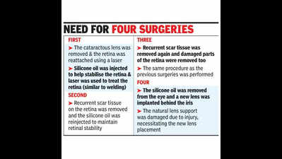 9-year-old almost loses vision after ignoring cricket ball injury, regains it after 4 surgeries