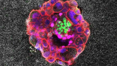 Real-time implantation of human embryo captured for the first time ever