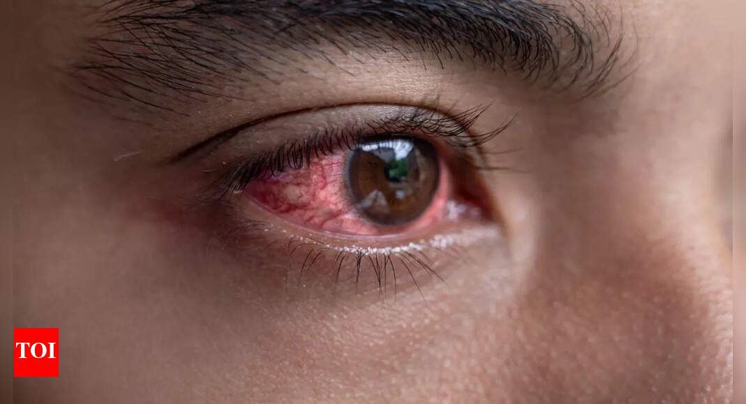 Your eyes could be warning you about cancer, diabetes, or high BP; here’s what to look for |