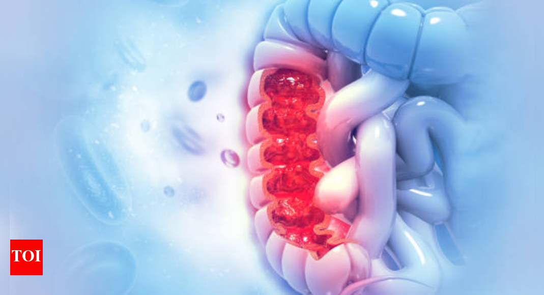 Colon cancer on the rise among youngsters: 5 warning symptoms that should not be ignored |