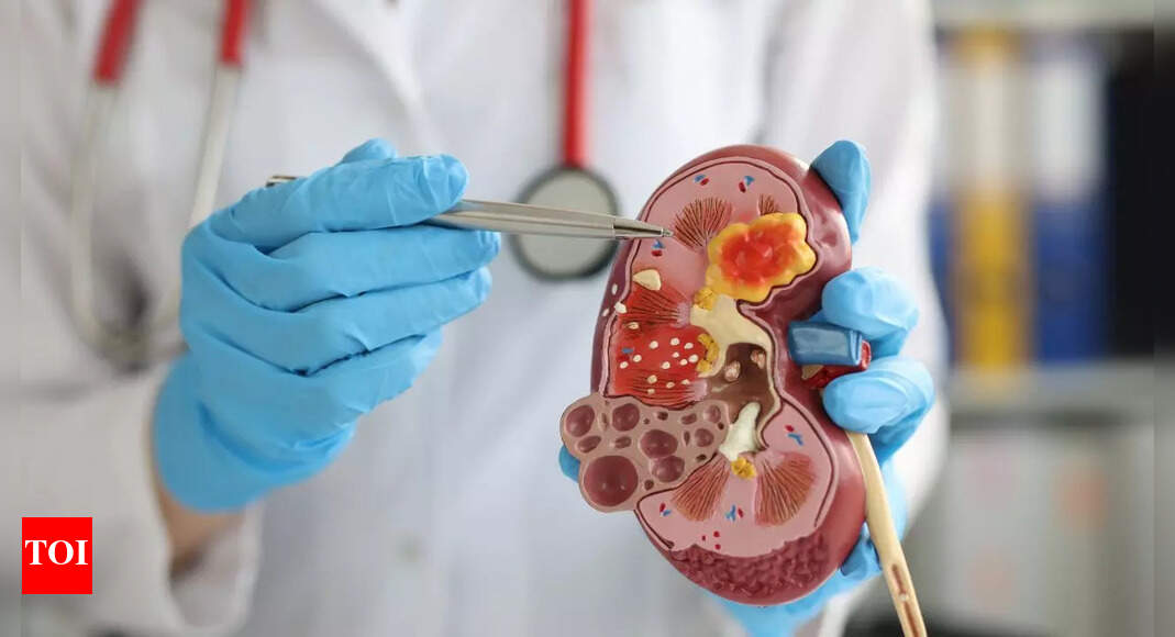 How to prevent kidney stones: Lifestyle changes and diet tips