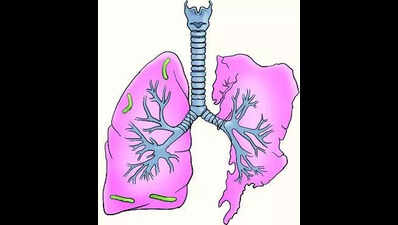 Lower respiratory infection on the rise among children