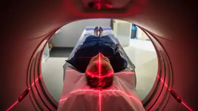 CT scan exposing more Americans to cancer; study links it with 100,000 new cancers across the US