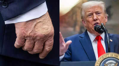 What’s going on with Donald Trump’s hands? Viral photos show large blotches of 'foundation' on POTUS' hands