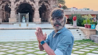 Meet Lalit Patidar: The Indian teen who suffers from  the werewolf syndrome