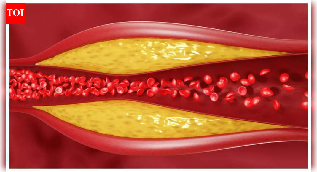 HDL vs LDL vs Triglycerides: How to optimally manage each form of ...