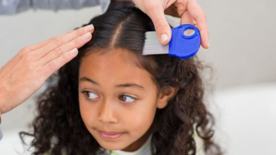 How to quickly remove lice from your kid’s hair